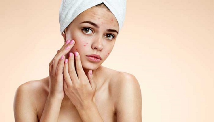Article about What to know about dry skin